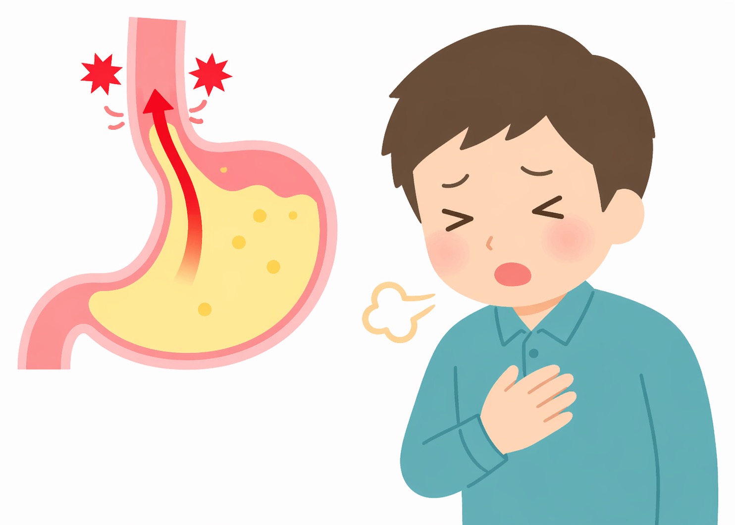 逆流性食道炎の原因と対策
